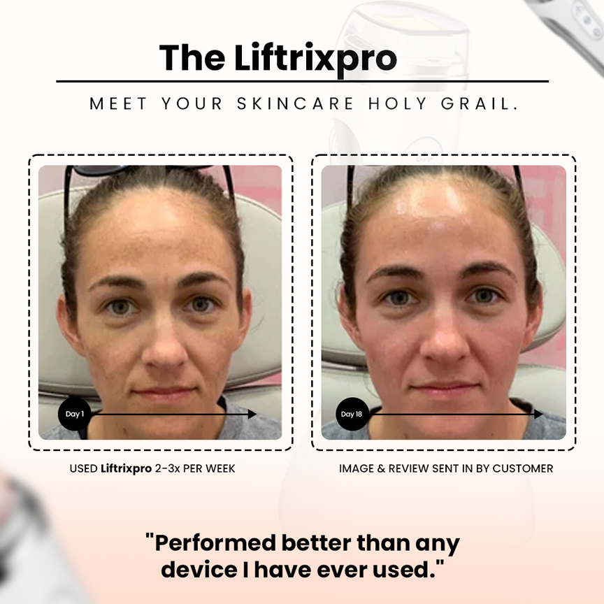 LiftrixPro Rejuvenate