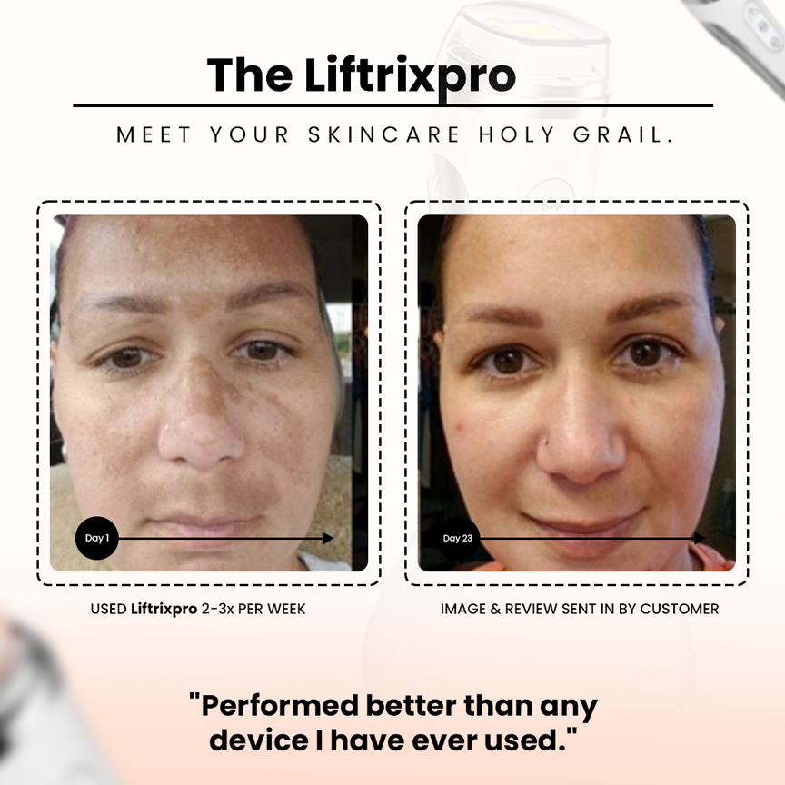 LiftrixPro Rejuvenate