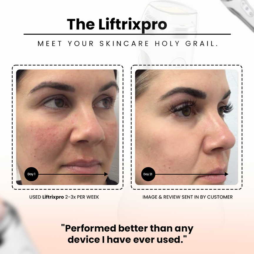 LiftrixPro Rejuvenate